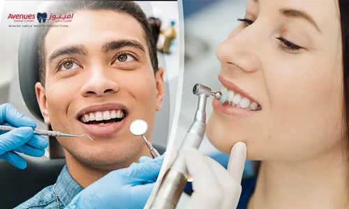 Dental Scaling & Polishing + Consultation!